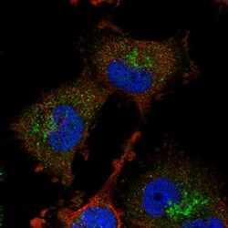 ADI1 Antibody, Novus Biologicals:Antibodies:Primary Antibodies